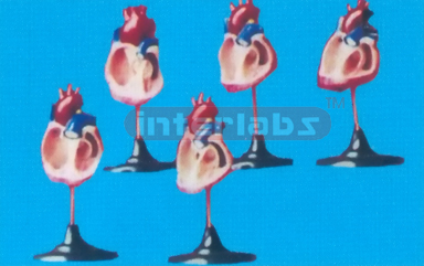 MODEL OF CONGENITAL MALFORMATION HEART